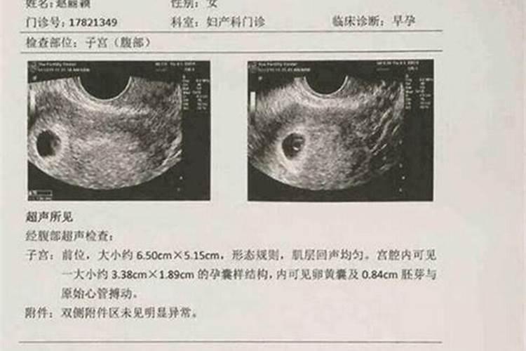 梦见楼房倒塌好吗什么意思